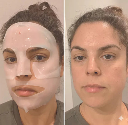 Kit colágeno- 1 Mascarilla hidratante facial+3 Parches para ojeras de colágeno