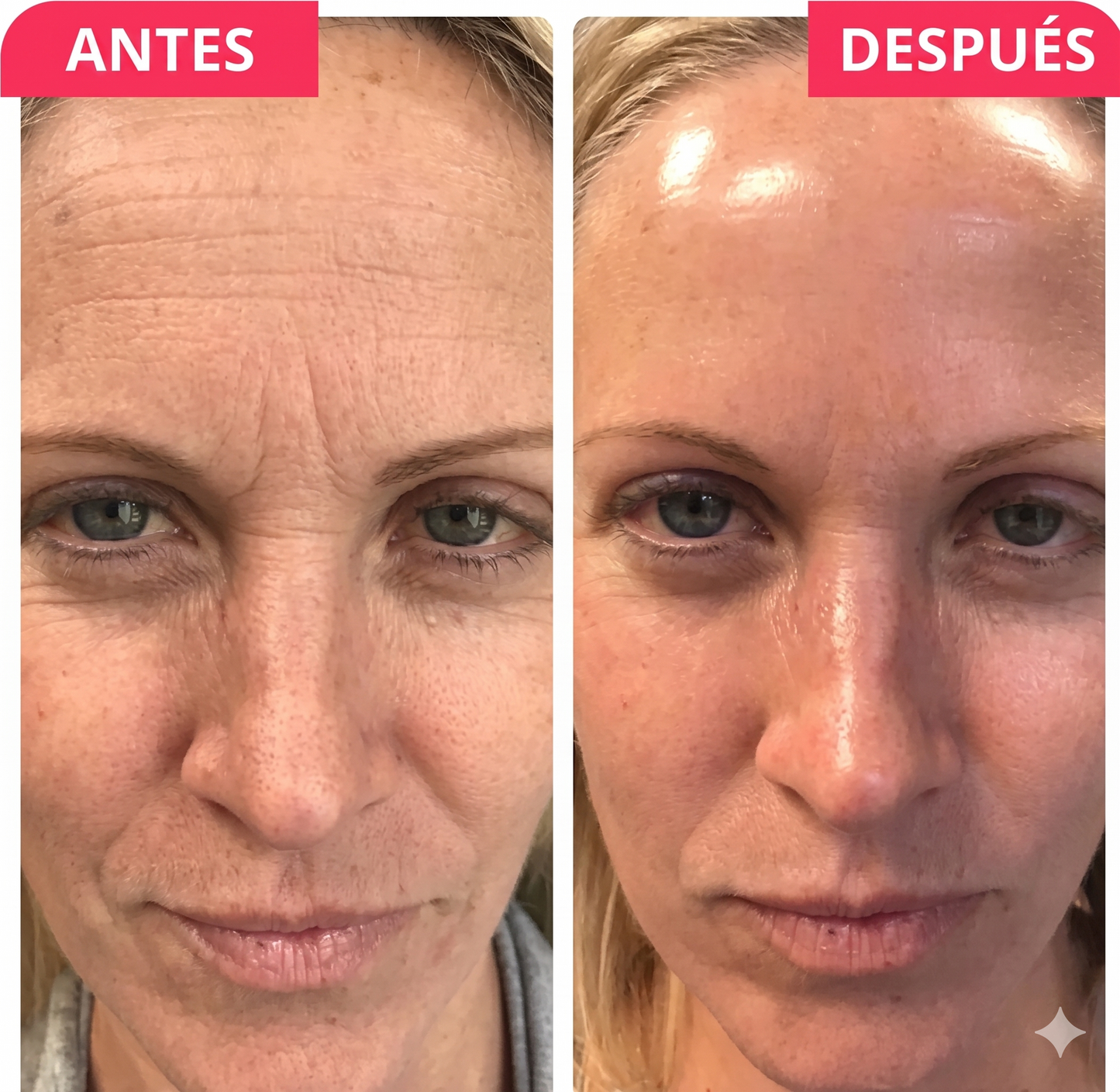 Glamora-Mascarilla Hidratante Facial con Biocolageno