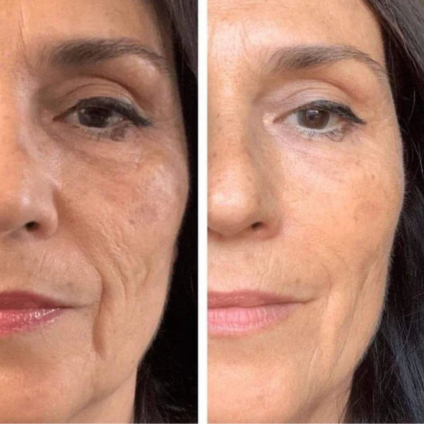 Kit colágeno- 1 Mascarilla hidratante facial+3 Parches para ojeras de colágeno