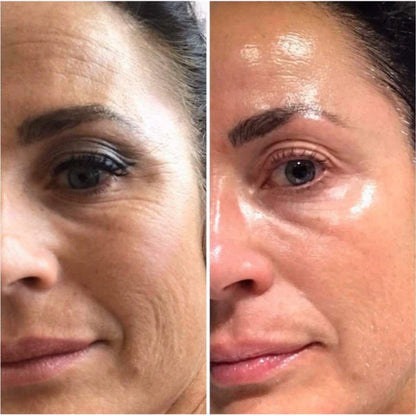 Kit colágeno- 1 Mascarilla hidratante facial+3 Parches para ojeras de colágeno